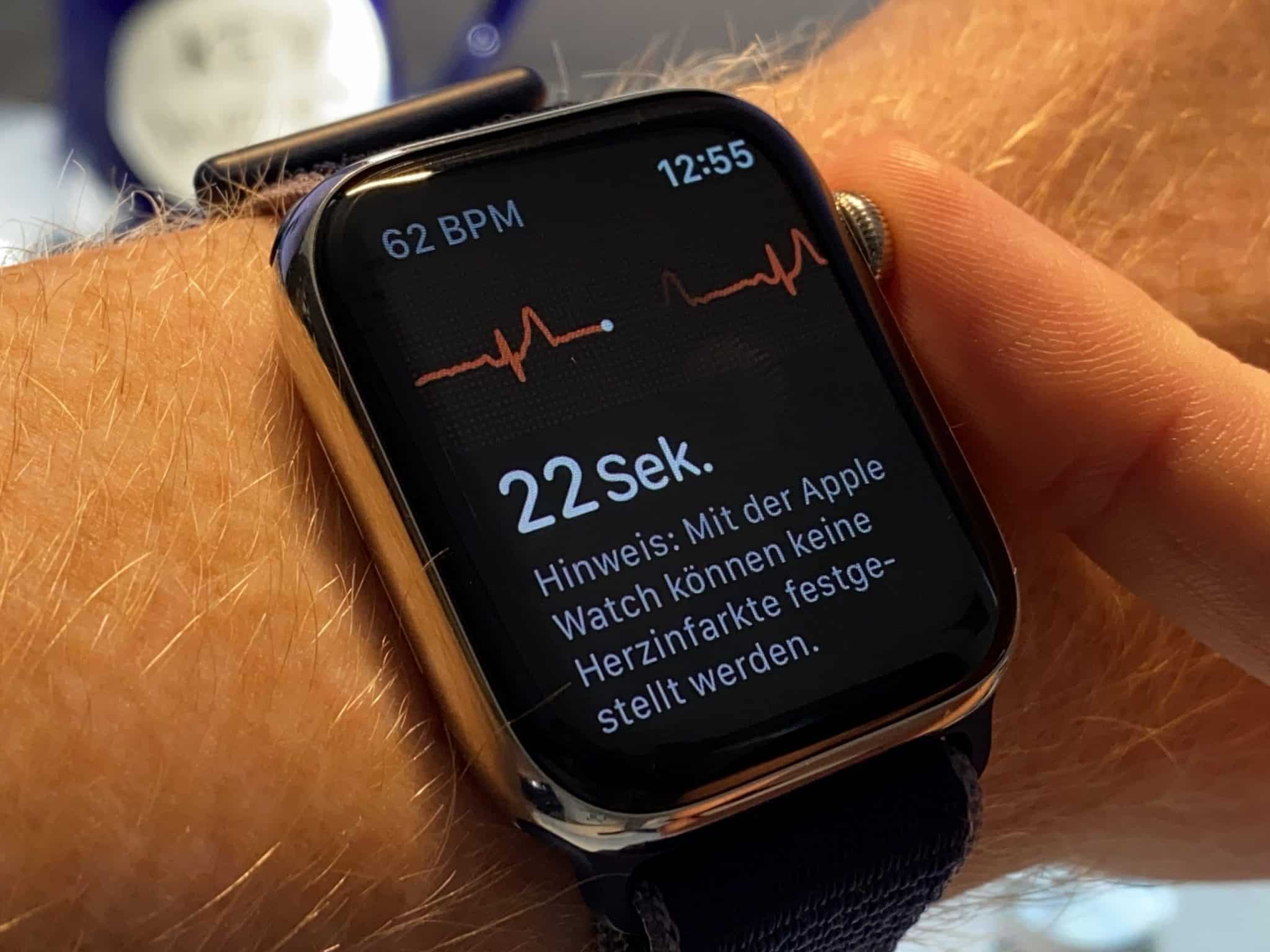 EKG (Elektrokardiogramm) – Was können Smartwatches mit EKG?
